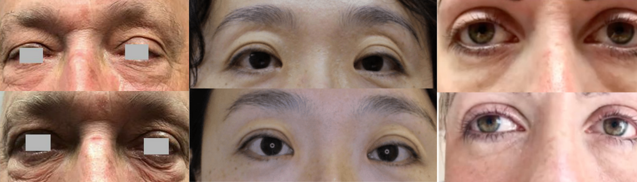 Smooth Eye