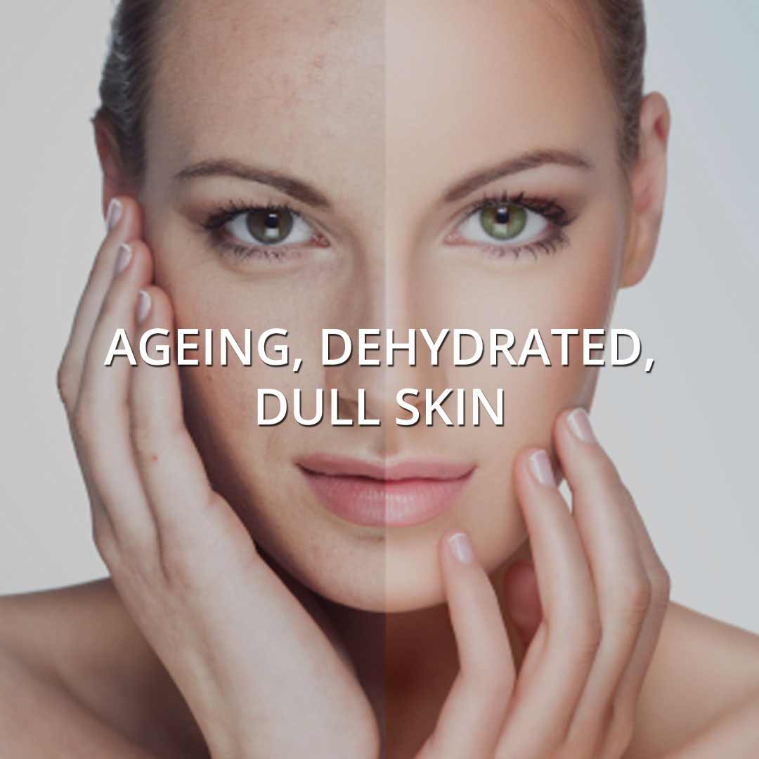 Ageing